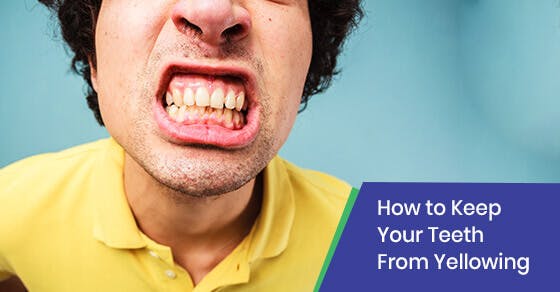 How to Keep Your Teeth from Yellowing