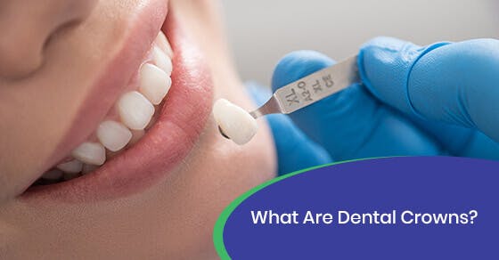 What Are Dental Crowns?